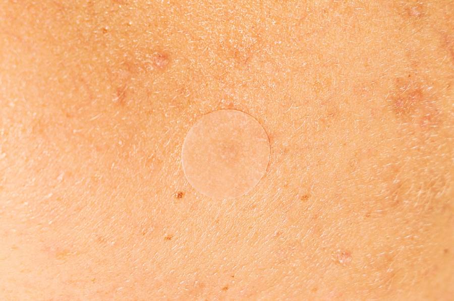 Pickel Rötungen wegbekommen – K-Beauty Tipps
